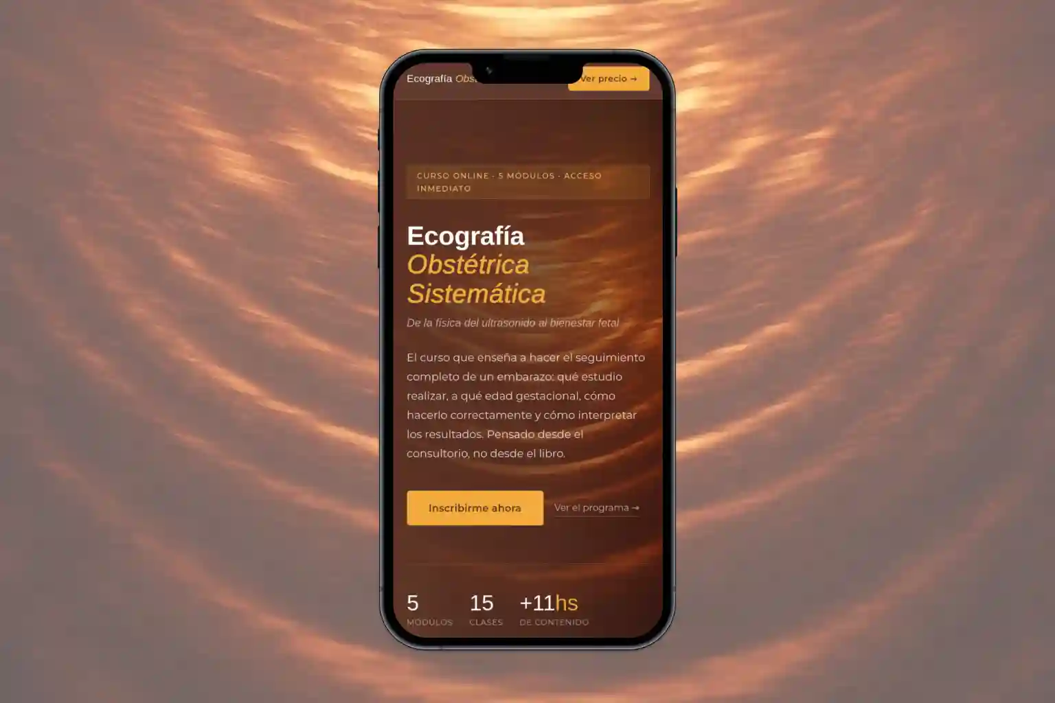 Ecografía Fetal
